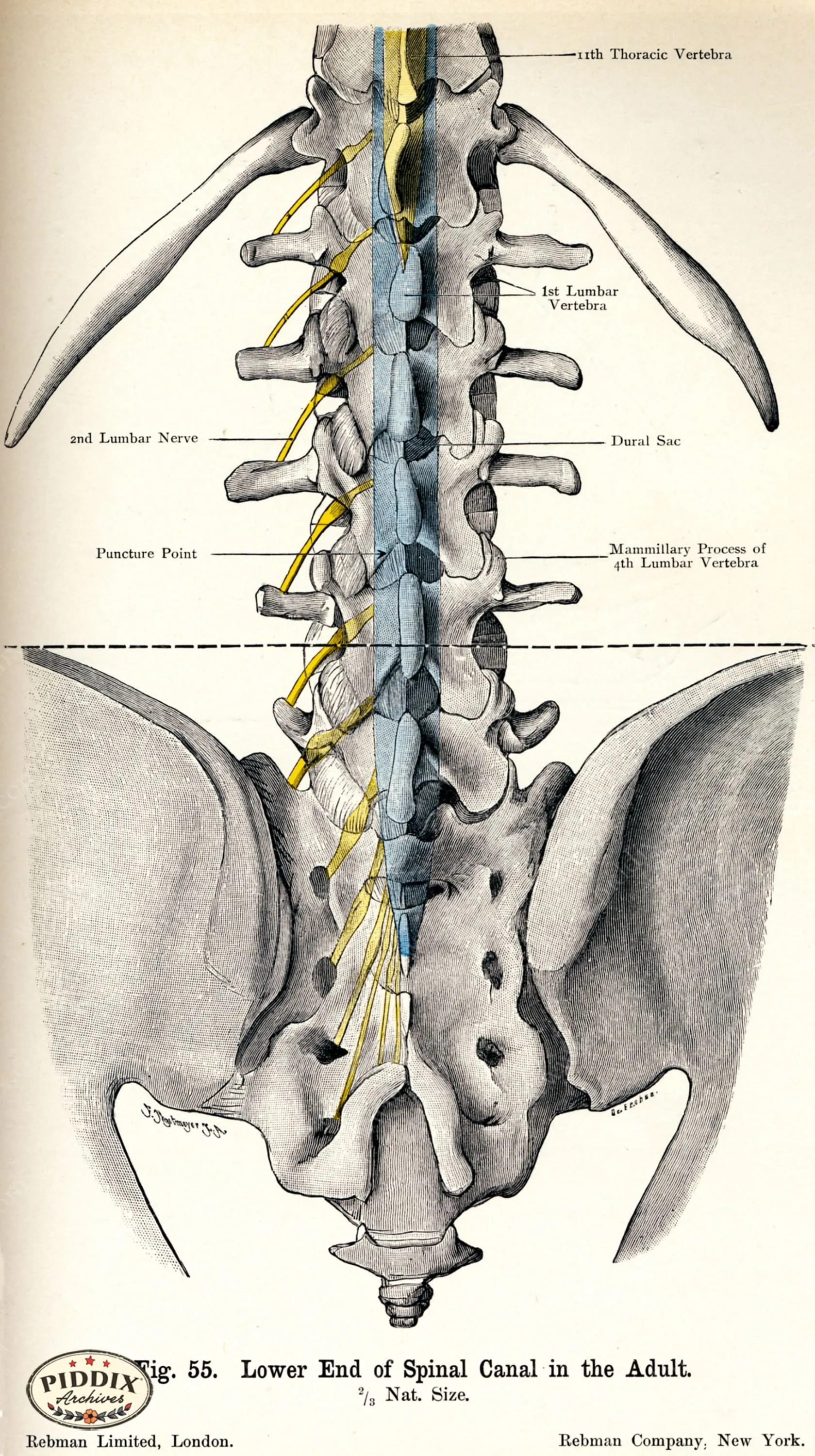 PDXC7205 -- Human Anatomy Spine